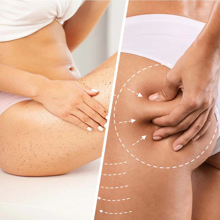 Niacin anticelulitni piling s kokosom za učvršćivanje i zaglađivanje kože 250 ml
