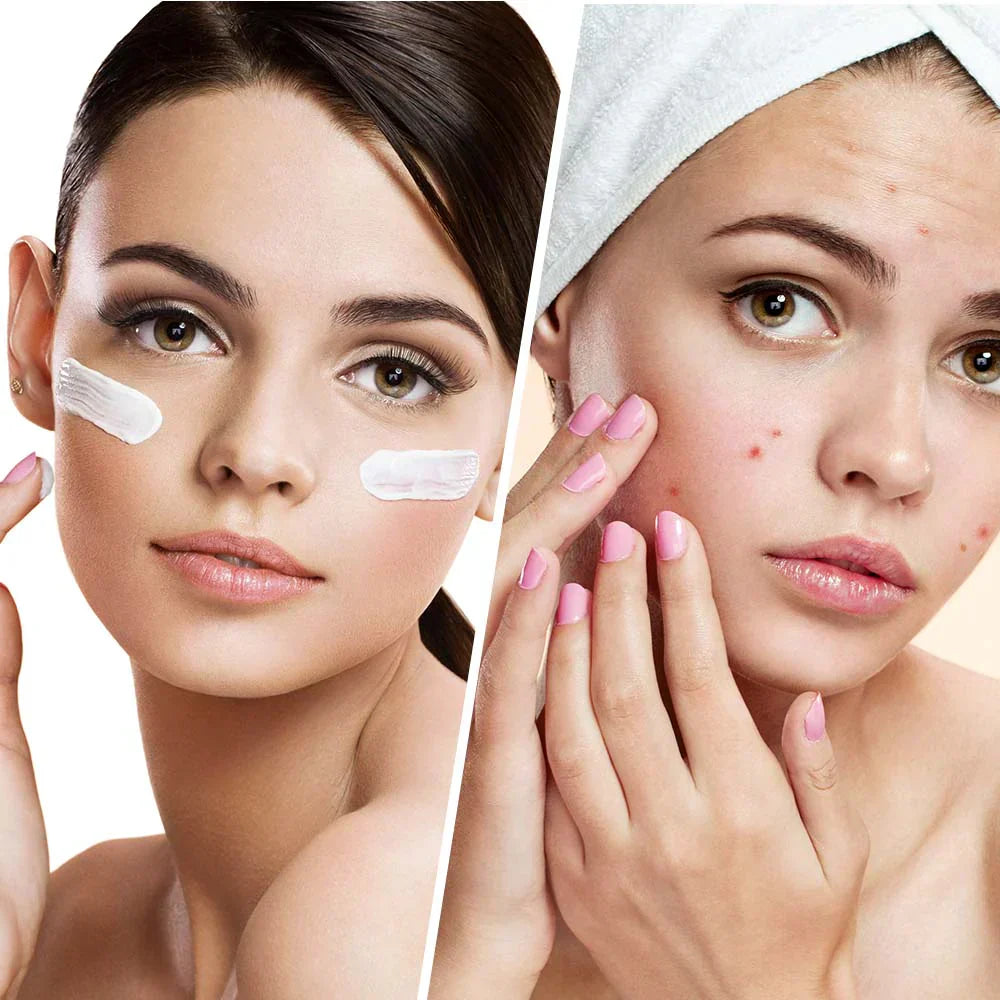 Clear Balance – Hidratantna krema za lice protiv prištića i nesavršenosti s niacinamidom 50 ml